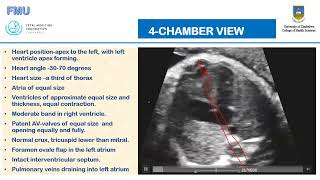 Fetal Heart Examination  Continuation [upl. by Enreval]