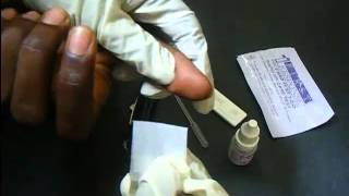 HIV Antibody Test Using A Rapid HIV Card [upl. by Nwahsak539]