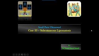 Ultrasound Case 33  Lipomatosis mimicking Lipoma [upl. by Adav]