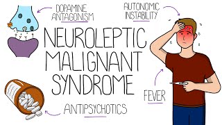 Neuroleptic Malignant Syndrome NMS Explained [upl. by Karlow]