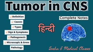 Tumor in CNS  Pathology  Hindi  Gross and Microscopic Pathology  Pathogenesis [upl. by Yblok]