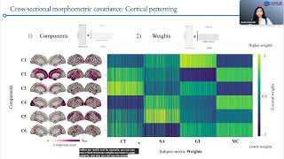 OHBM 2022  135  Talk  Hadis Kalantar Hormozi  Human Brain Development a crosssectional and l… [upl. by Kania729]