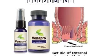 External Hemorrhoid Treatment [upl. by Leahcir]