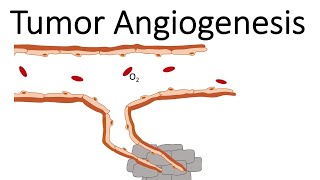 Tumor Angiogenesis [upl. by Harias489]