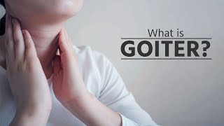 What is goiter  what is goiter disease  what is goiter thyroid  what is goiter symptoms [upl. by Eihcir]