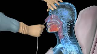 How to insert a nasogastric tube for NG intubation  3d animation [upl. by Annabal]