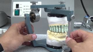 Custom Incisal Guide Table 13 What is this thing [upl. by Ariaek]