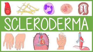 Scleroderma [upl. by Joella]