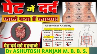 Abdomen pain cause पेट दर्द को कैसे पहचाने Acute abdominal painAbdomen pain symptom medical school [upl. by Coke]