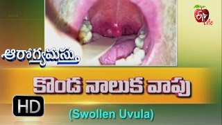 Aarogyamastu  Swollen Uvula  6th January 2017  ఆరోగ్యమస్తు [upl. by Eimaral]