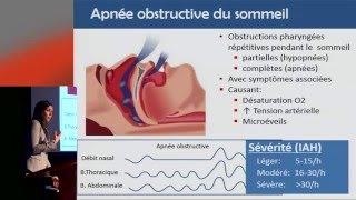 Apnée du sommeil en périopératoire de chirurgie bariatrique [upl. by Navad]