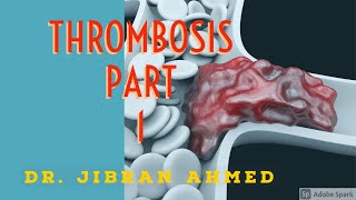 GENERAL PATHOLOGY II THROMBOSIS II PART 1 II CHAP 4 II ROBBINS 10TH EDITION [upl. by Rolandson858]