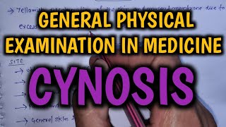 Cyanosis  General Physical Examination in Medicine  Final Year MBBS Practical Exam [upl. by Einuj971]