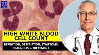 HIGH WHITE BLOOD CELL COUNT LEUKOCYTOSIS What is What is leukocytosis Definition of leukocytosis [upl. by Rodney]