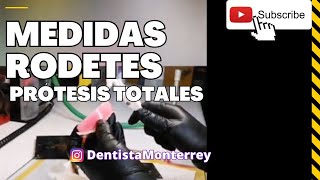 🤔CUÁNTO MIDEN ❓Los RODETES de CERA 👅 Prótesis TOTALES [upl. by Philbo818]