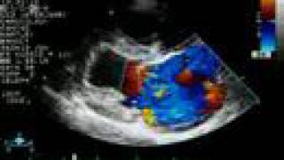 Mitral Regurgitation  Color Doppler Echocardiogram  Dog [upl. by Drida]