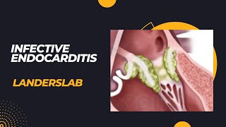 Infective Endocarditis [upl. by Krystal]