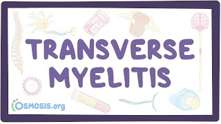 Transverse myelitis  an Osmosis Preview [upl. by Dloniger]