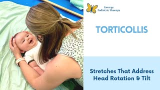 Torticollis 2 Stretches To Try At Home [upl. by Jordanson]