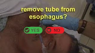 What to do if you suspect ET tube in Esophagus Endotracheal Intubation [upl. by Pauly]