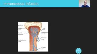 Intraosseous Infusion  Australian Paramedical College [upl. by Joelly635]