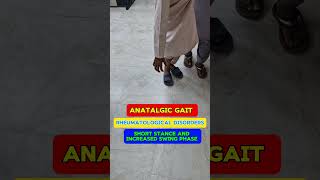 Antalgic gait video of patient  analysis example  description and pattern of Gait gait [upl. by Ark692]