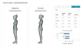 3D Body Scanning  Postural Assessment Software PAS  Fit3D [upl. by Valenka411]