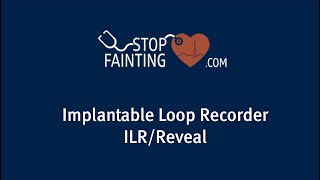 Implantable Loop Recorder [upl. by Yraek]