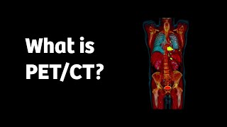 What is PETCT and how does it work [upl. by Nolyk]