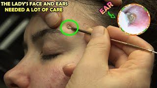 FEMALE EAR AND FACE CLEANING  SKIN CARE  HOT TOWEL  ASMR FEMALE THERAPY  BAYAN CİLT BAKIMI asmr [upl. by Lemraj13]