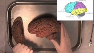 MIT Introduction to Neuroanatomy Series Part 1 [upl. by Ahsai]