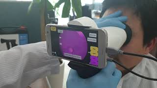 WFC01Portable fundus camera using smartphone [upl. by Suirauqed]