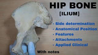 Hip joint  Bones ligaments blood supply and innervation  Anatomy  Kenhub [upl. by Naor144]