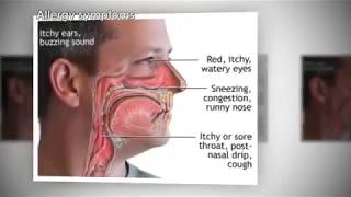 How Allergies Work Animation  Why Allergic Reactions Occur Video  Symptoms Sneezing Treatment [upl. by Carmine]