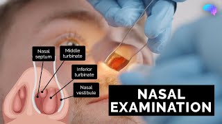 Nasal Examination  Nose Examination  OSCE Guide  UKMLA  CPSA [upl. by Hgalehs]