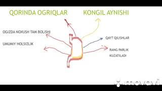 Gastrit Kasaligini kelib chiqishi Belgilari va Davolash [upl. by Thacker813]