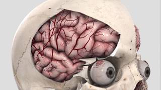 Orbitozygomatic approach [upl. by Tiebout]