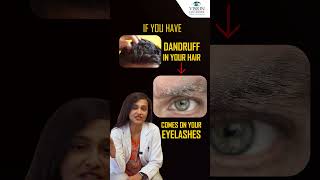 5 Causes Stye on Your Eyelid   How To Get Rid Of Stye From Eye  Vision Eye Centre [upl. by Delaryd157]