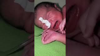 This baby very smart and intelligent 🤓 newborn baby remove oxygen tube with own hands 30 second [upl. by Adanar]