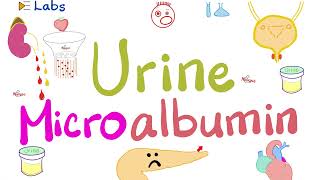 Microalbumin in the Urine Microalbuminuria  Diabetes Mellitus amp Kidney Disease  Nephrology Labs [upl. by Ebanreb]