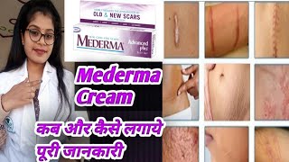 Mederma Cream  Mederma Cream honest review  Mederma Cream benefits uses amp side effects in hindi [upl. by Anirret]