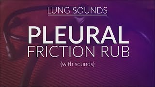 Pleural Friction Rub  Pleural Rub [upl. by Ttevi2]