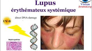 Lupus érythémateux Systémique Signes cliniques Biologiques physiopathologie [upl. by Ariaz577]