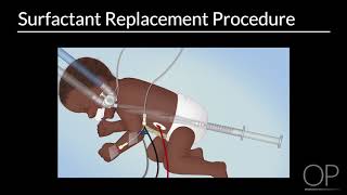 Surfactant Replacement in Neonates by B Walsh  OPENPediatrics [upl. by Cornwell]