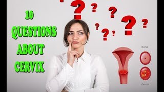 Cervix  10 questions to answer to help you decide whether or not to keep your cervix [upl. by Denis949]