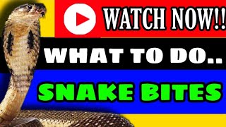 EMERGENCY FIRST AID  SNAKE BITE  WHAT TO DO IN SNAKE BITE [upl. by Lahpos404]