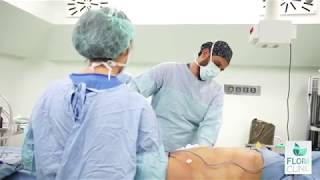 Vaser Liposuction Ameliyatı İzle  Flora Klinik [upl. by Ilecara580]