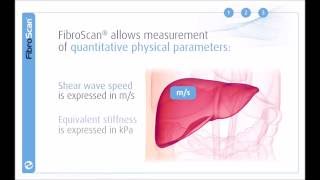 3 Stages of the FibroScan examination [upl. by Tacy77]