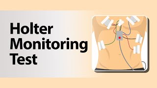 Holter Monitoring Test [upl. by Jea]