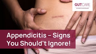 Signs of Appendicitis You Shouldnt Ignore  GUTCARE [upl. by Ennaeiluj]